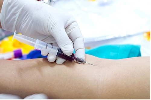 Punção e Coleta de Sangue e Amostras Biológicas 