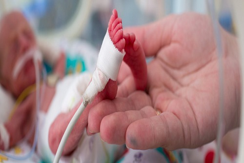 Acessos Vasculares ( Neonatal e Pediátrico )
